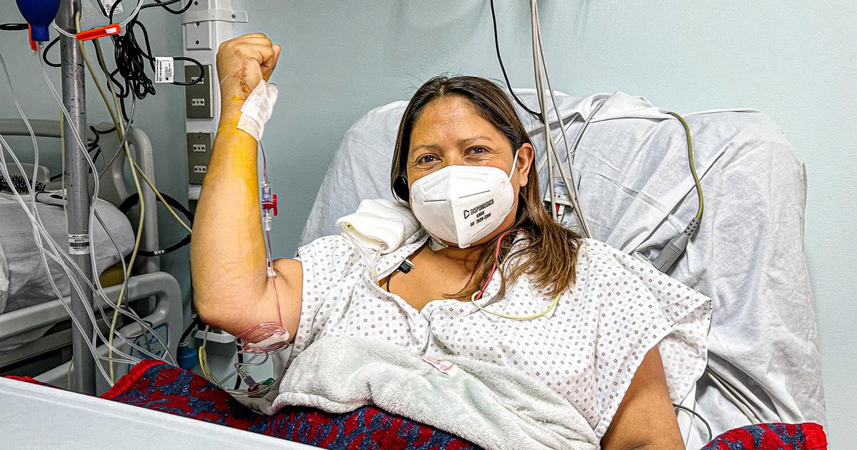 Tras 15 años en espera, paciente recibe trasplante renal en el Hospital de Temuco